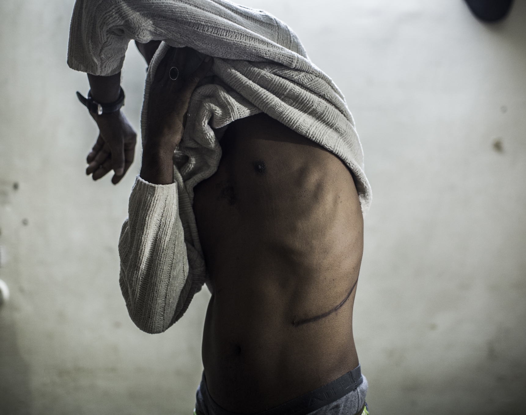 Behind India’s kidney rackets, an acute shortage of organs
